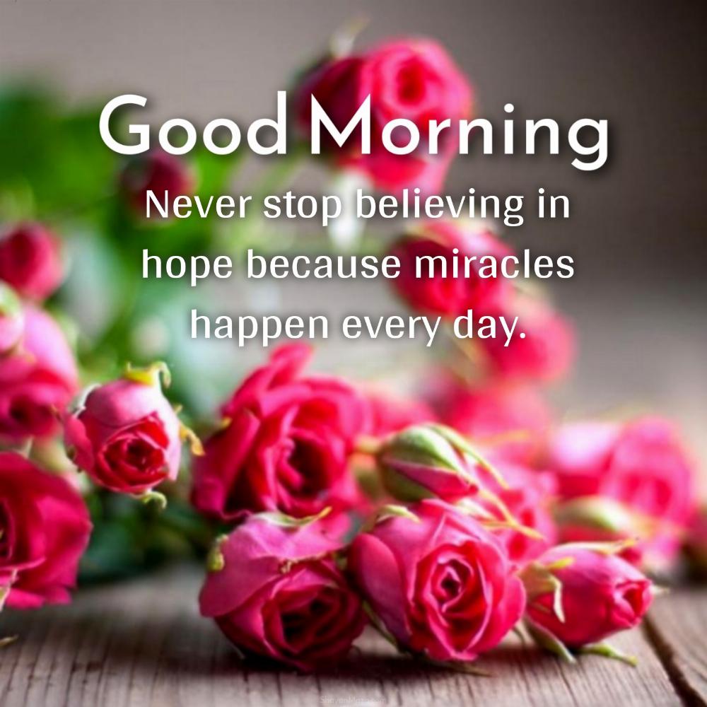 Never stop believing in hope because miracles happen every day